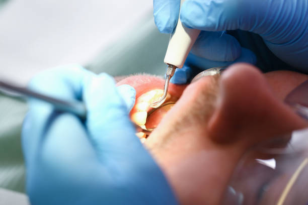 Best After-Hours Dental Trauma Care in Yukon, OK