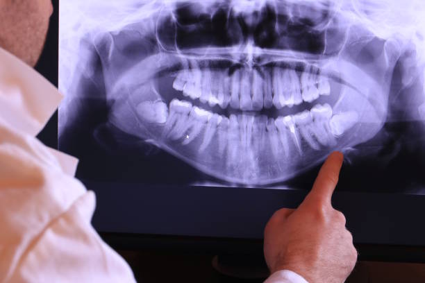 Best Urgent Care for Lost Fillings or Crowns in Yukon, OK
