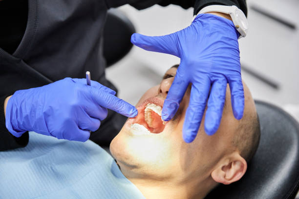 Best Emergency Wisdom Teeth Removal in Yukon, OK